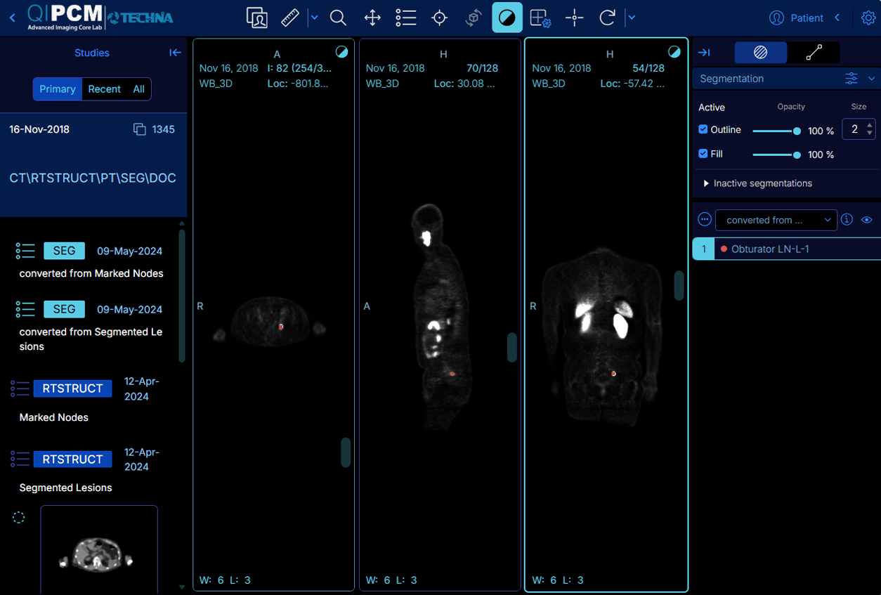 Quantitative Imaging for Personalized Cancer Medicine (QIPCM)
