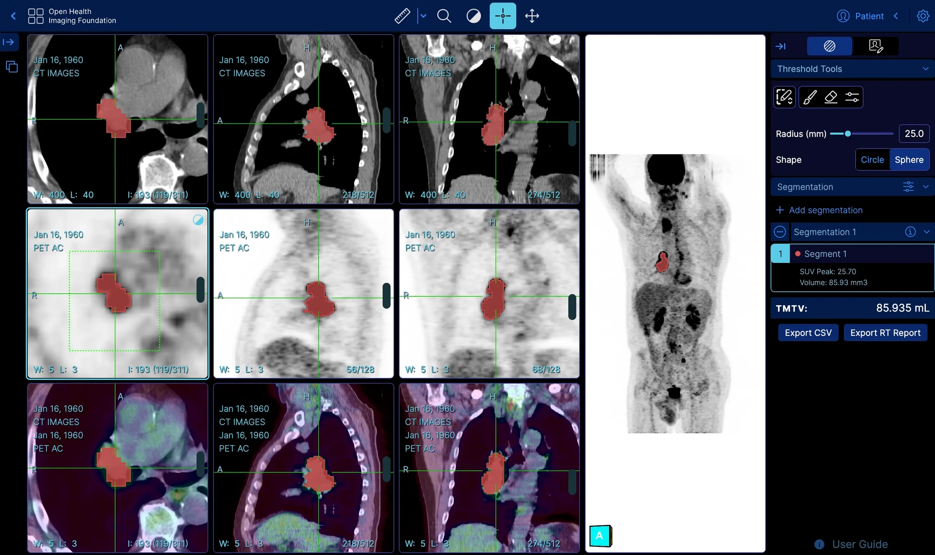 PET/CT