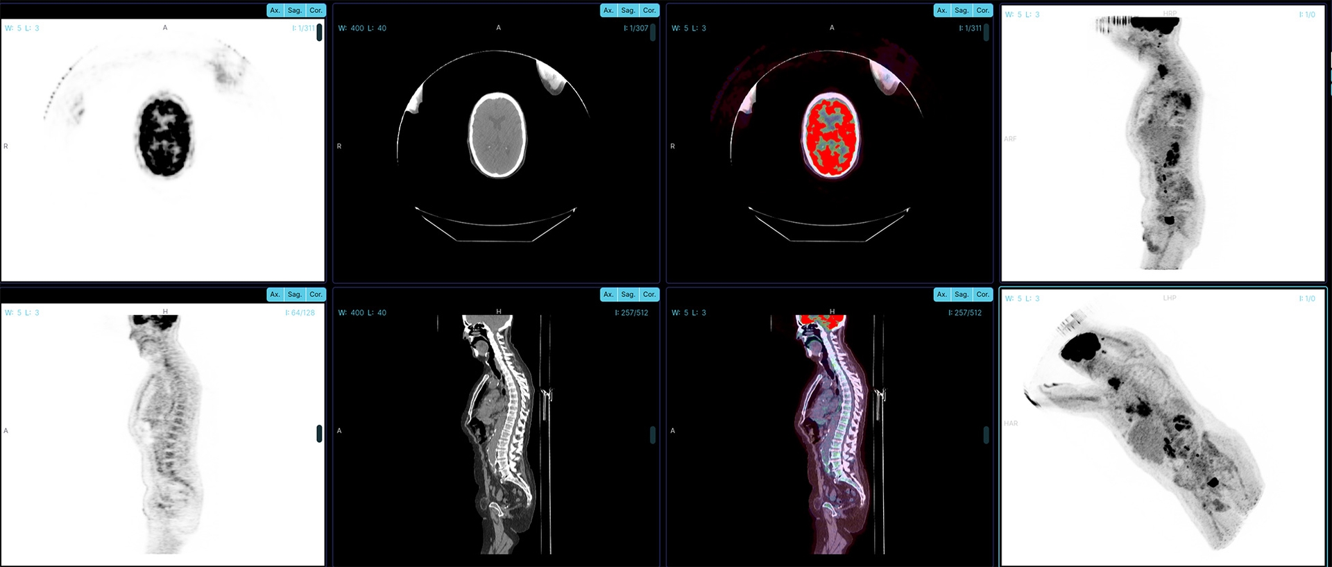 Product showcase OHIF